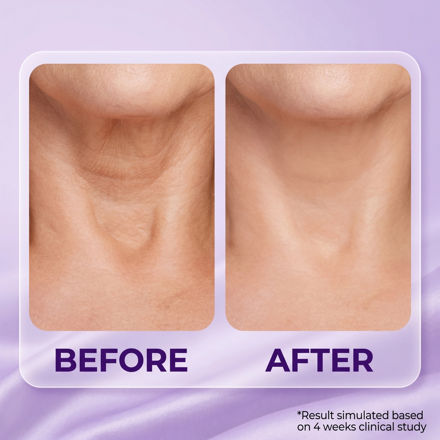 Roller Massage Neck Cream š§“ Collagen & Hyaluronic Acid | Firms Neck, Reduces Wrinkles & Double Chin