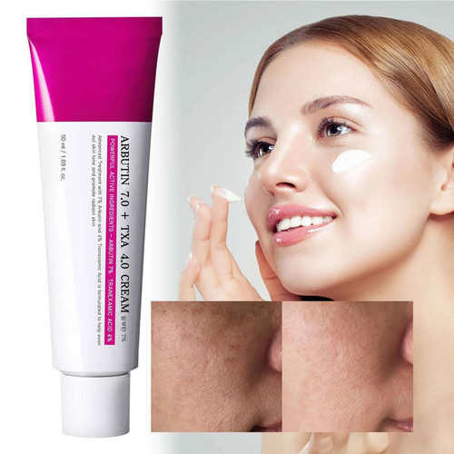 🔥Last Day 70% OFF 💦Arbutin 7% + Tranexamic Acid 4% Cream