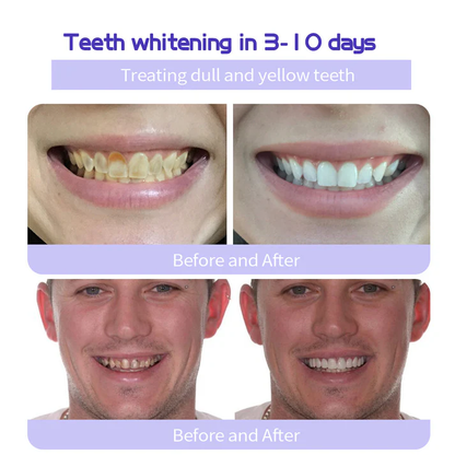 🔥Ends Tonight: Get 40% OFF Before It’s Gone!🎁 Fluoride-Free Hydroxyapatite Toothpaste for Whitening & Sensitive Enamel Care