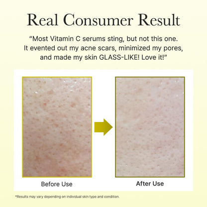 Limited Time: Save 40% 🔥NESLEMY Vitamin C Booster Shot
