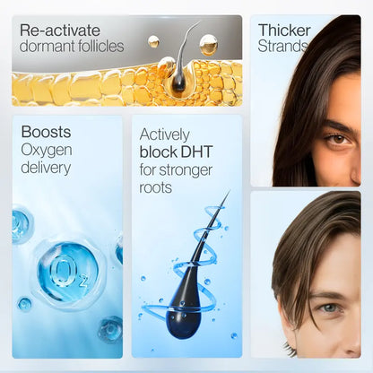 Buy 1 Get 1 Free – Last Day🔥Advanced Hair Density Roll-On Serum - Hair Density Miracle, Anti Hair Fall Scalp Care for Men & Women