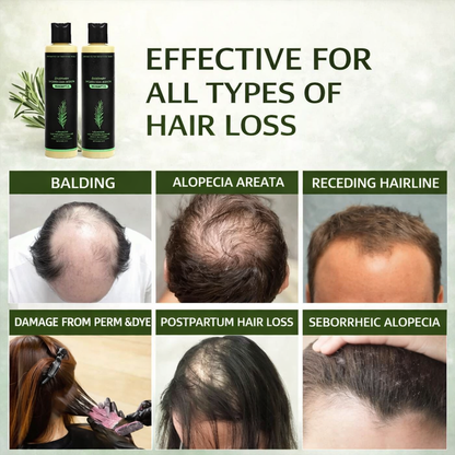 🔥 Thicker, Stronger Hair Starts Here — Rosemary Keratin Shampoo That Works