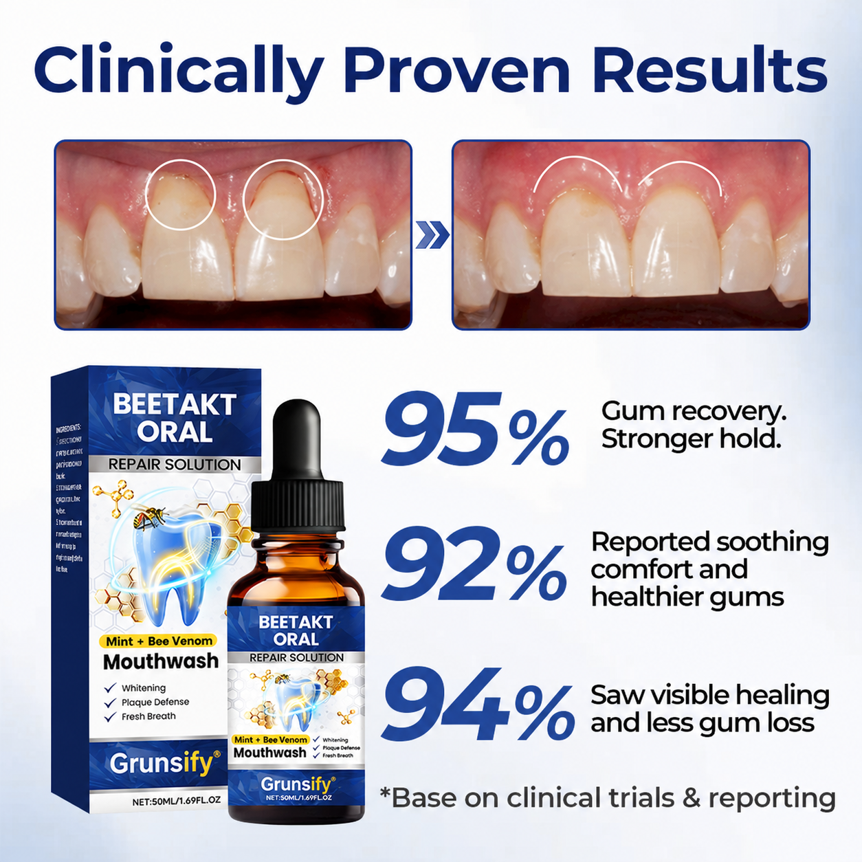 Buy 1 Get 1 Free🔥Grunsify® BeeTakt Oral Repair Solution