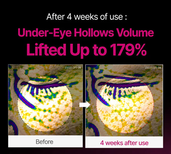 Cemenrete Calcium Dark Spot Eye Cream