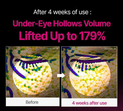 Cemenrete Calcium Dark Spot Eye Cream