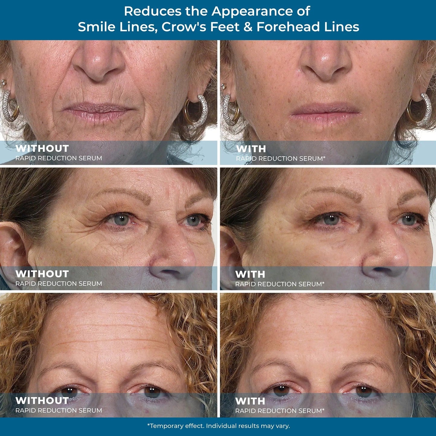 NESLEMY Rapid Reduction Eye Serum- Anti Aging Wrinkle Remover for Face, Scientific formula for easy absorption without greasiness10ml Tightening Skincare Comfort-HS