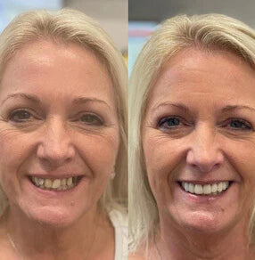 ⏰Last day-Buy 1 Get1 Free🔥NESLEMY-Hydroxyapatite Whitening Toothpaste
